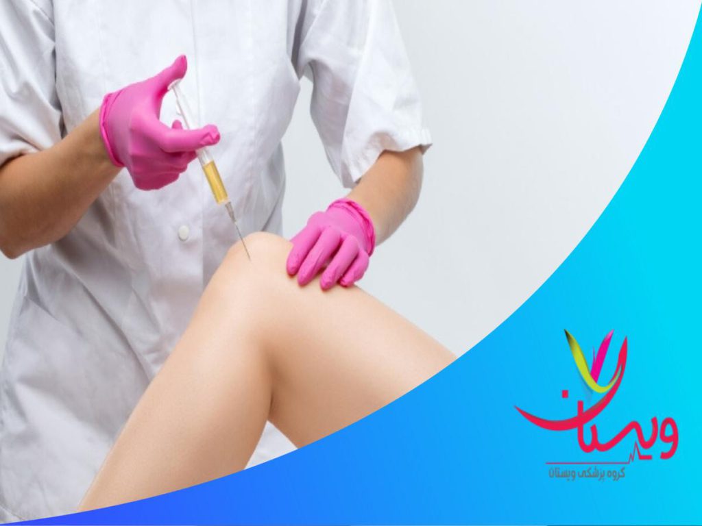 ترمیم غضروف تکنیک svf چیست