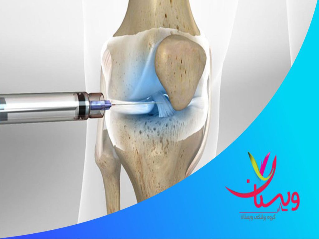 فیزیوتراپی مراحل انجام تزریق چربی SVF به زانو