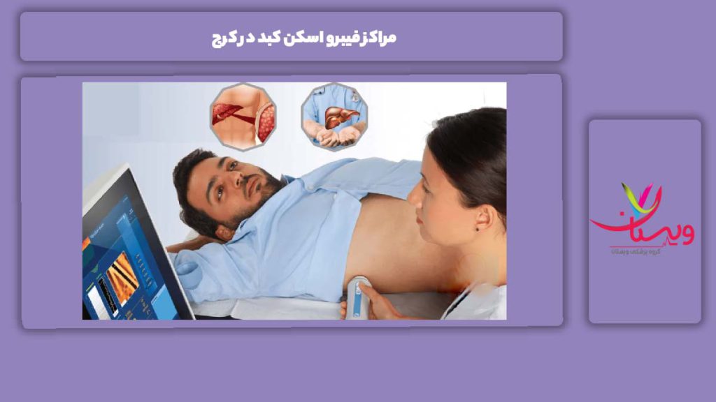 خدمات این مراکز مراکز فیبرو اسکن کبد در کرج