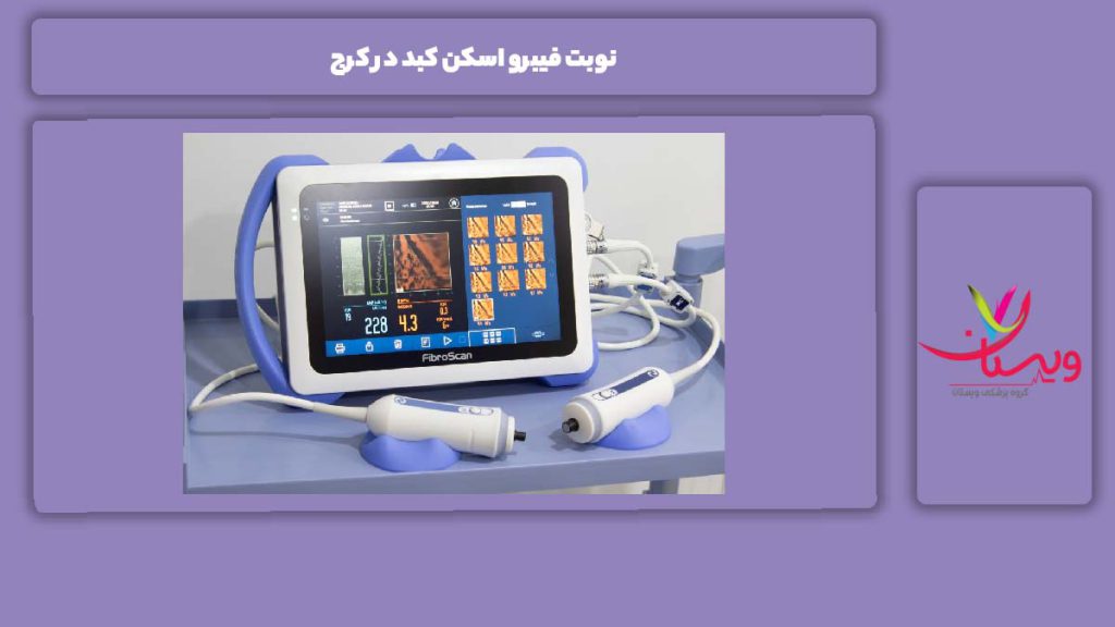 نکات قبل از رزرو نوبت نوبت فیبرو اسکن کبد در کرج