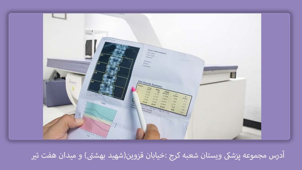 تعرفه در مراکز کرج هزینه سنجش تراکم استخوان با بیمه تامین اجتماعی