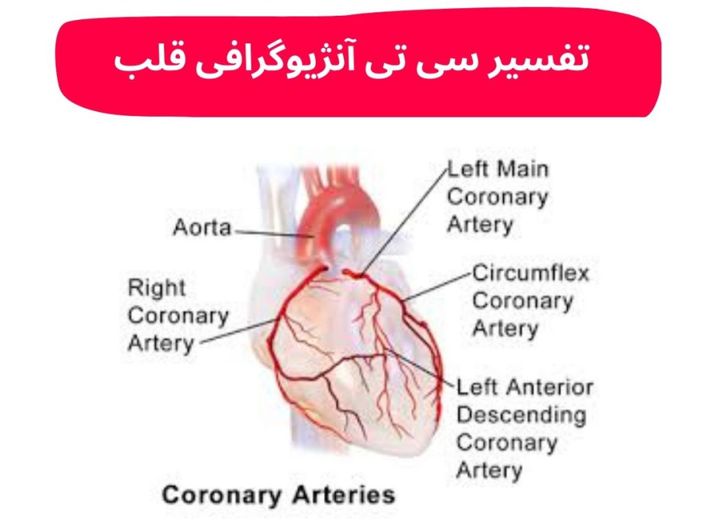 اصطلاحات سی تی آنژیوگرافی قلب