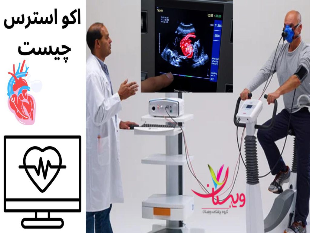 تست غیرتهاجمی و ایمن اکو استرس چیست