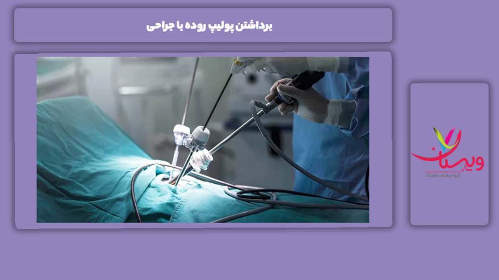 ویژگیهای برداشتن پولیپ روده با جراحی برداشتن پولیپ روده با جراحی