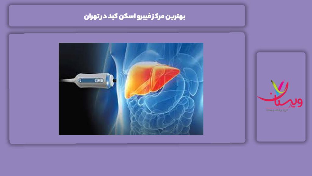 ویژگیهای بهترین مرکز بهترین مرکز فیبرو اسکن کبد در تهران
