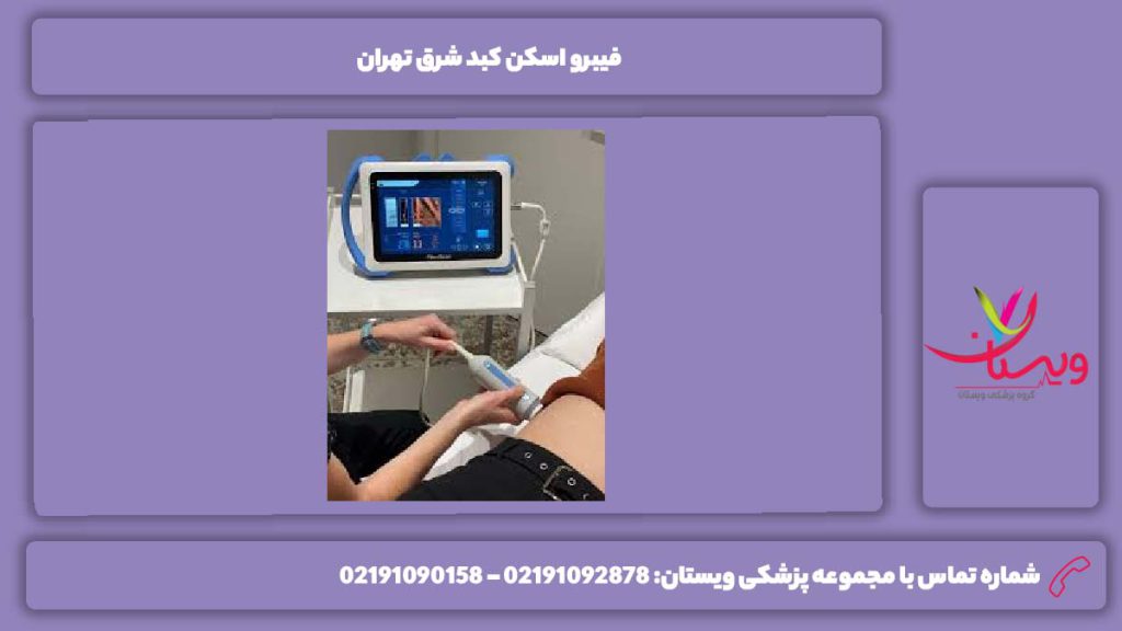 افرادی که نیاز به فیبرو اسکن کبد دارند فیبرو اسکن کبد شرق تهران