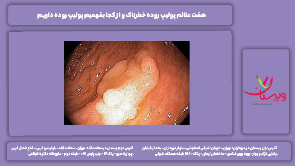 علائم پولیپ روده خطرناک