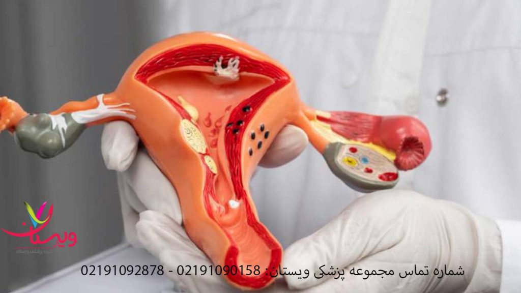 واژینوپلاستی همراه با لابیاپلاستی هزینه عمل تنگی واژن با لابیاپلاستی