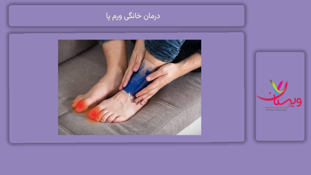 راه و روش درمان در منزل درمان خانگی ورم پا