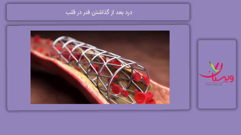 روش کاهش درد درد بعد از گذاشتن فنر در قلب