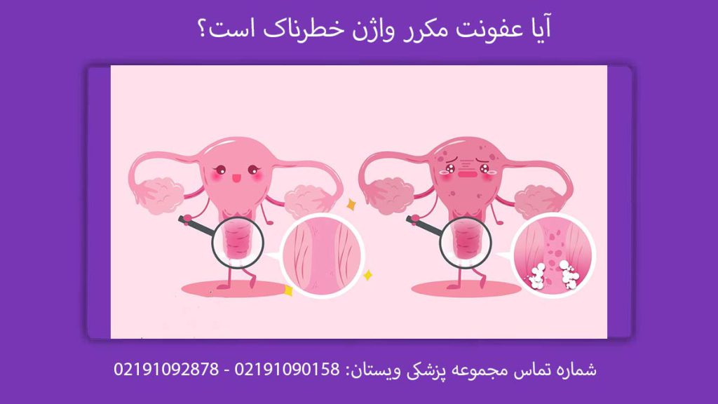 آیا عفونت مکرر واژن خطرناک است؟ علائم عفونت واژن در دختران، خطرات عفونت واژن مکرر