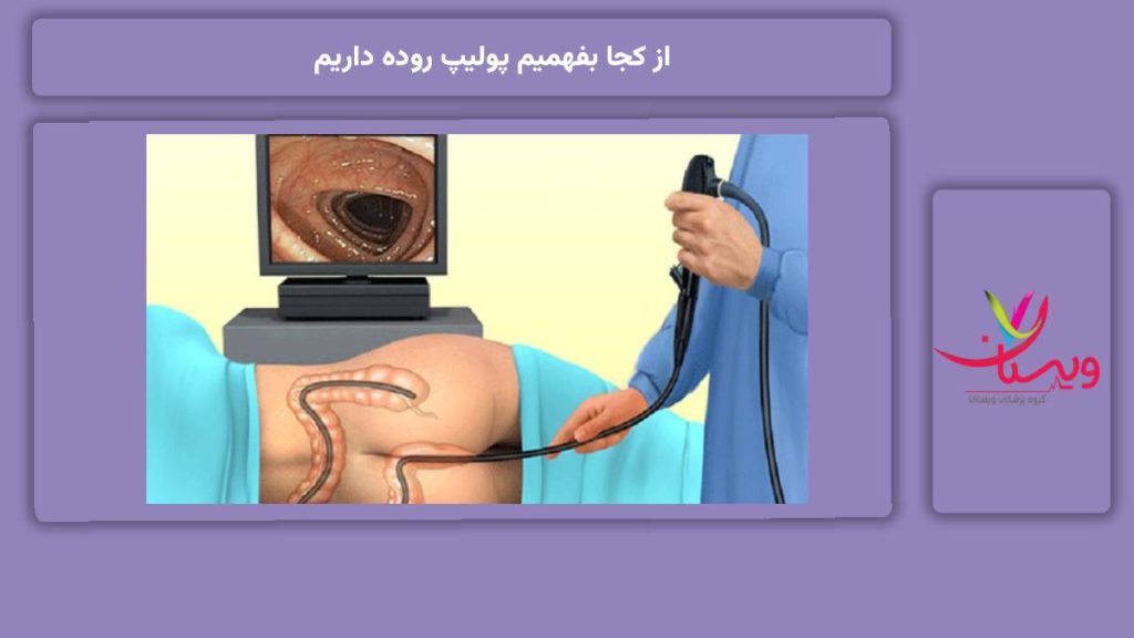 روشهای قطعی تشخیص پولیپ روده از کجا بفهمیم پولیپ روده داریم