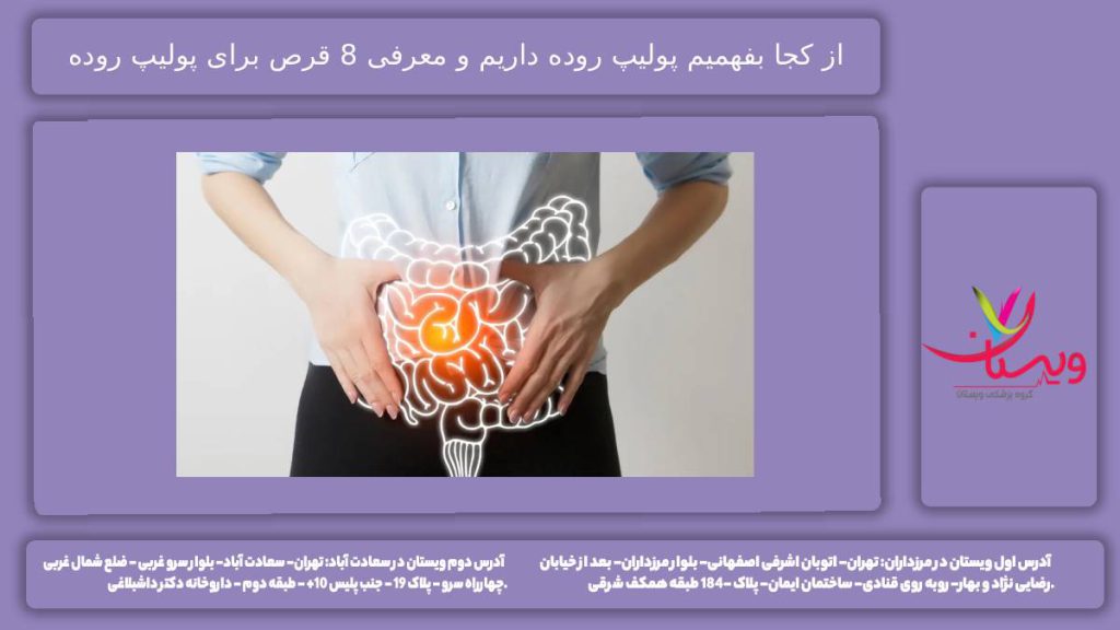 از کجا بفهمیم پولیپ روده داریم