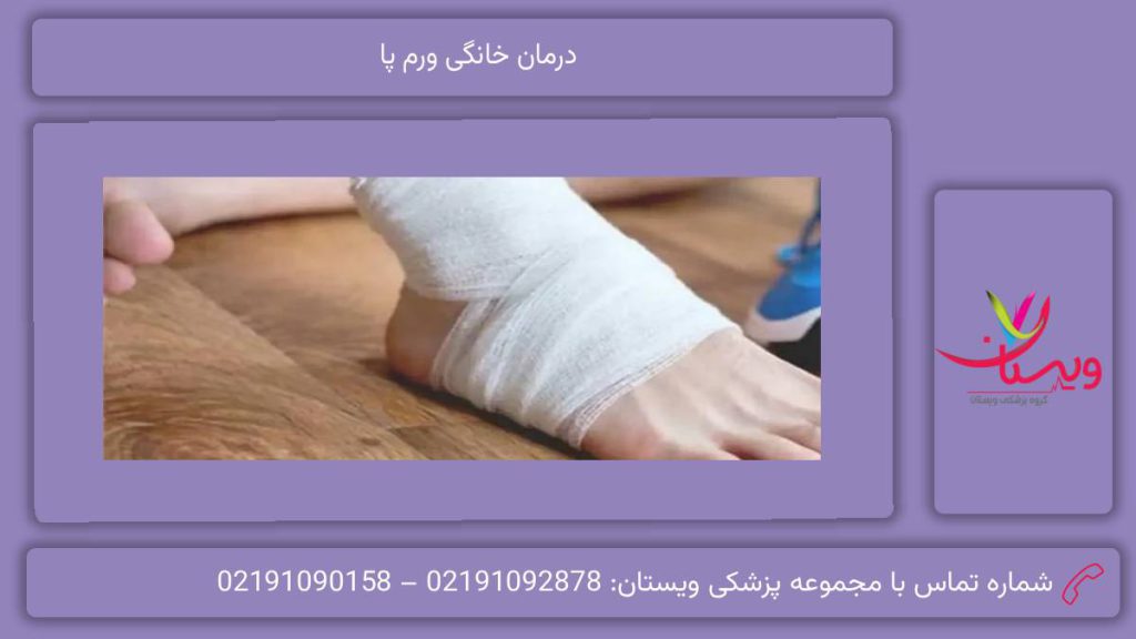 مهمترین روشهای درمان درمان خانگی ورم پا