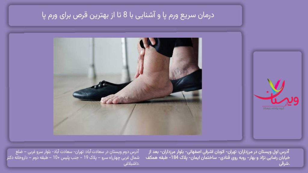 درمان سریع ورم پا
