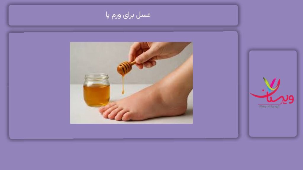 روشهای استفاده از عسل برای کاهش ورم عسل برای ورم پا