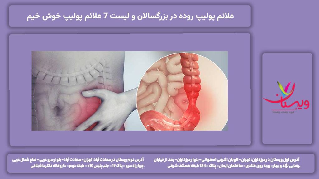 علائم پولیپ روده در بزرگسالان