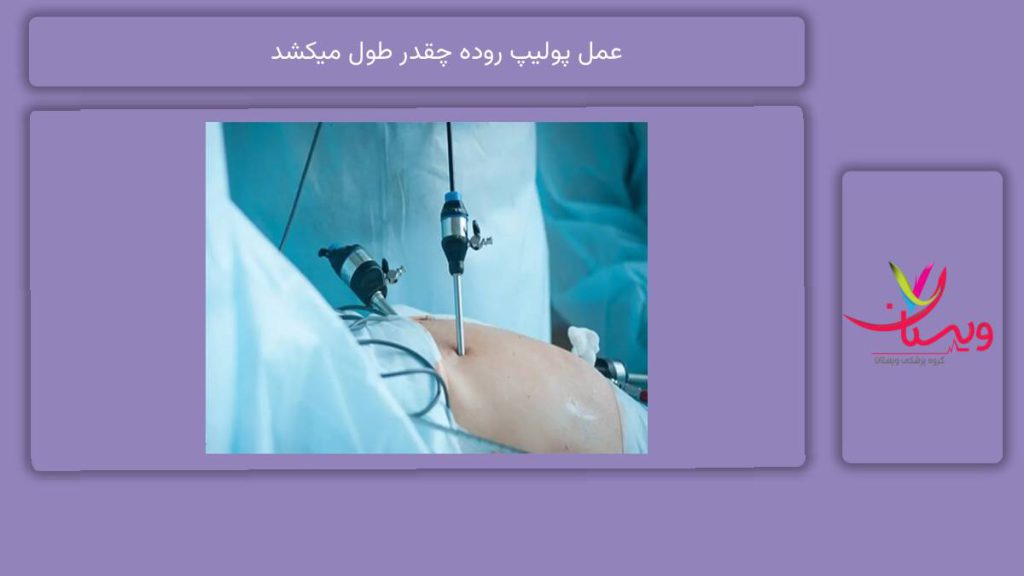 عوامل مؤثر بر طول عمل عمل پولیپ روده چقدر طول میکشد