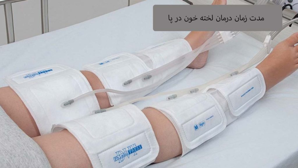 طول درمان DVT چقدر است؟ مدت زمان درمان لخته خون در پا