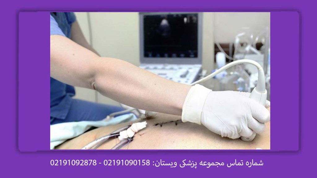 هزینه اکو قلب قیمت اکو قلب طرف قرارداد نیروهای مسلح