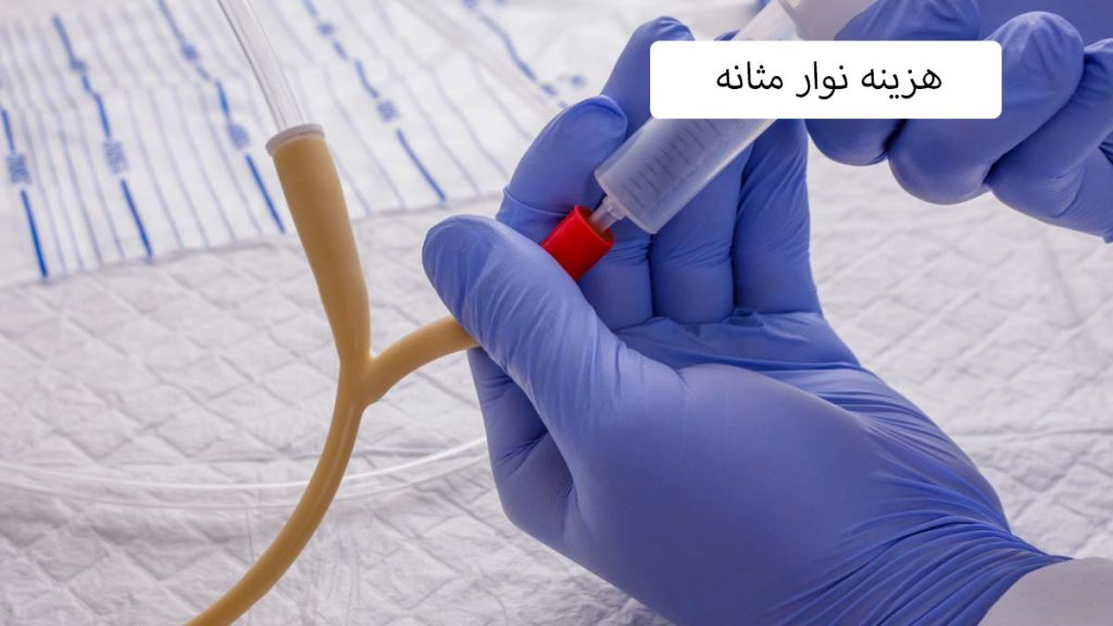 هزینه نوار مثانه